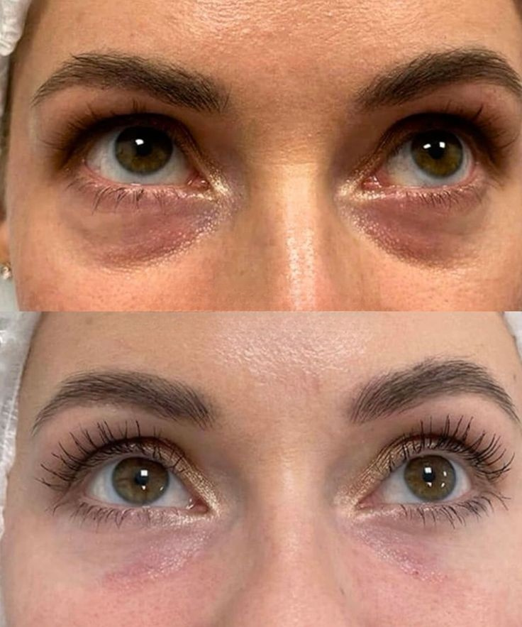 Kết quả điều trị 2