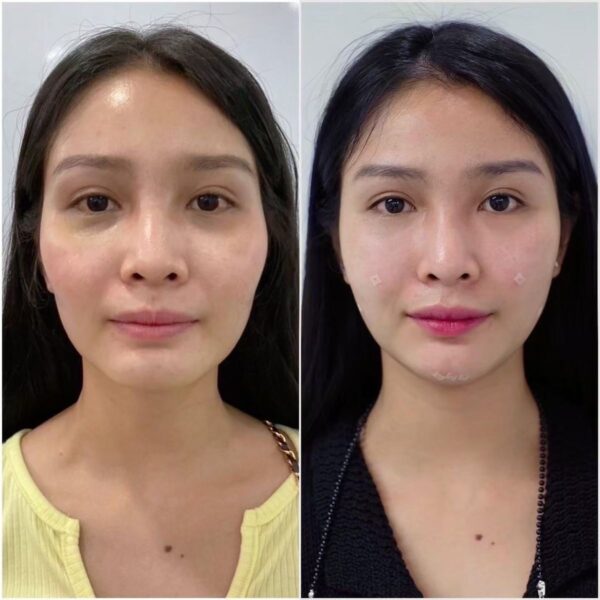 Kết quả điều trị 3